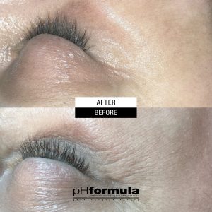 Bolton phformula eye treatment