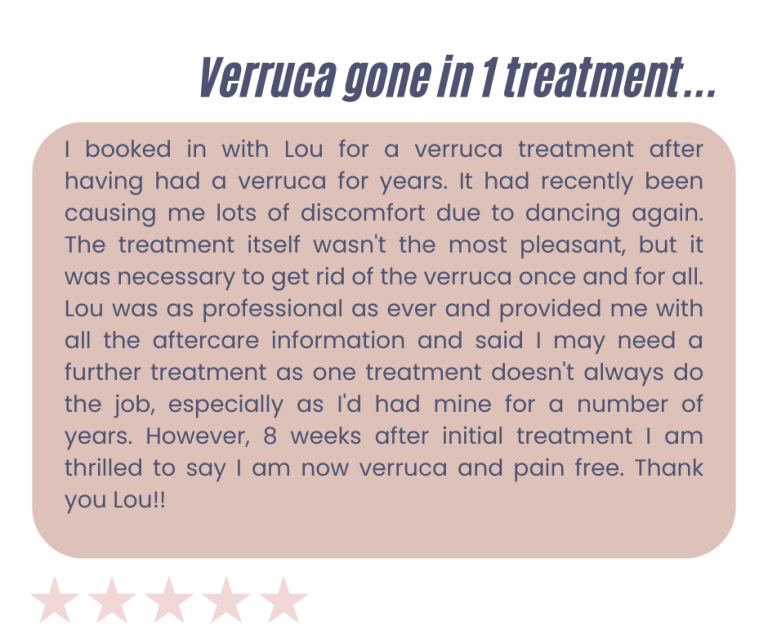 Westhoughton verruca removal advanced electrolysis